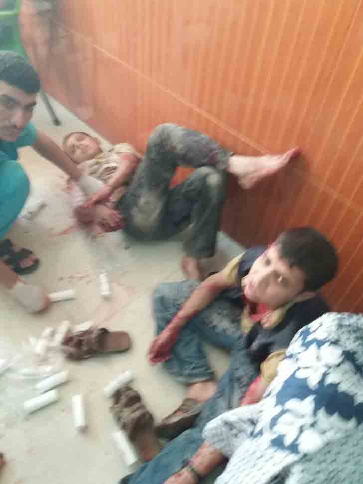В результате атаки джихадистов несколько детей получили ранения